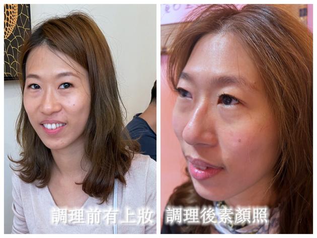 彰化微針美容 姸の美容工作室 活動照片